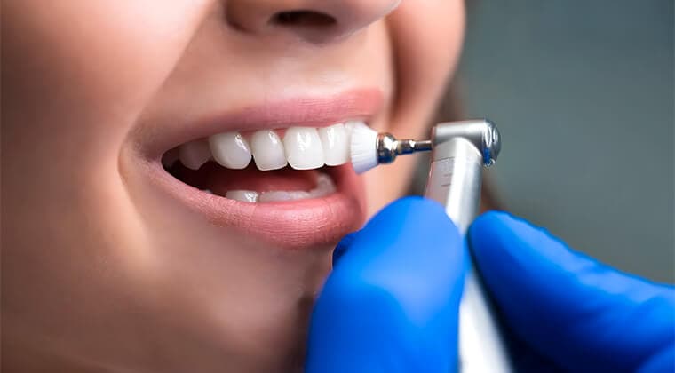Limpieza dental
