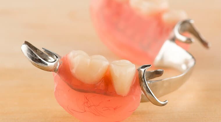 Prótesis dental
